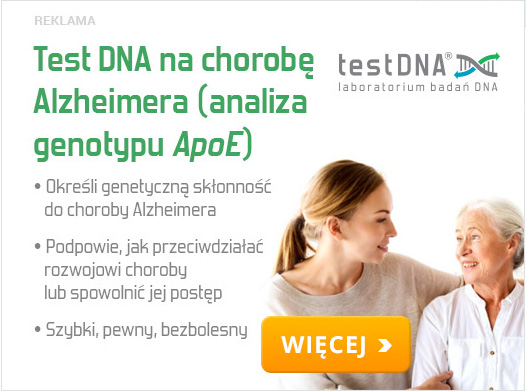 baner-alzheimer