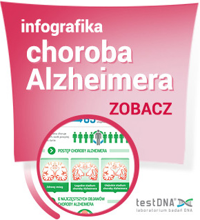 choroba alzheimera infografika