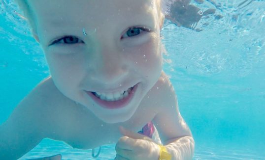 Zaburzenia napięcia mięśniowego