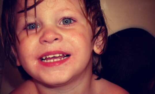 wada serca u dziecka