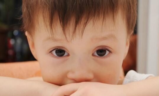 Choroba Bylera Choroba Bylera