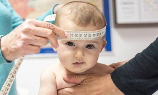 makrocefalia makrocefalia